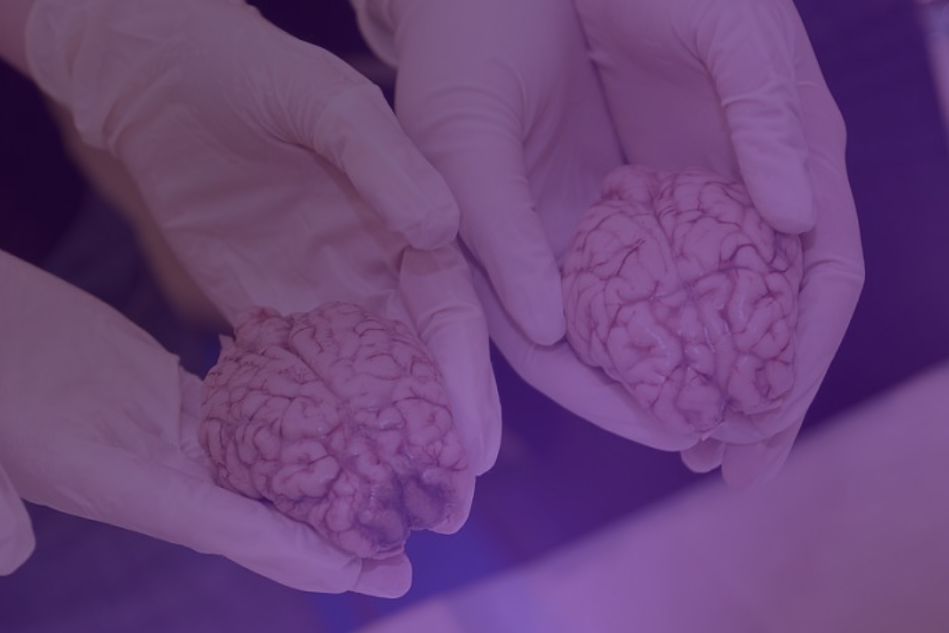 human-cognition